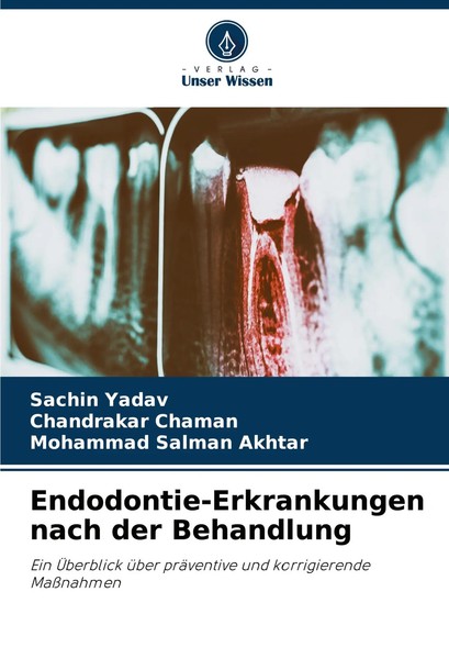 Endodontie-Erkrankungen Nach Der Behandlung Sachin Yadav (U. A.) Taschenbuch-image