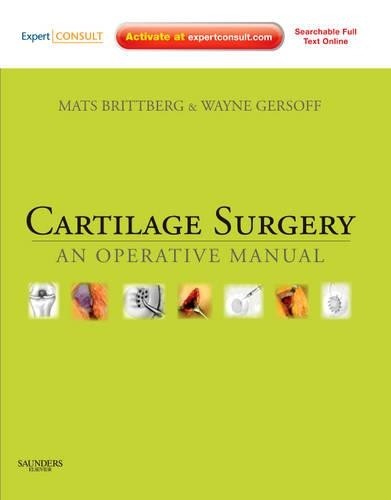 Cartilage Surgery - 9781437708783