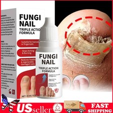 Fungi-Nail Anti-Fungal Liquid Solution Kills Fungus That Can Lead To Nail