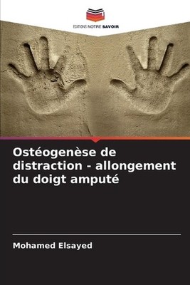 Ostogense de distraction - allongement du doigt amput by Mohamed Elsayed (French