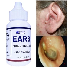 EAR DROPS SILICA ALKALINE SOLUTION Tinnitus Fungi Deafness Infection By ALKAVITA