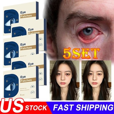 15x Lutein Eye Patches Relieve Eye Fatigue Dry Eyes Astringent Eyes Dark Circles