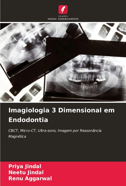 Priya Jindal (U. A.) | Imagiologia 3 Dimensional Em Endodontia | Taschenbuch-image