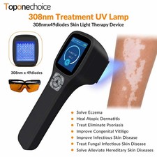 308nm Excimer UVB Device 64 Diodes Efficiency Targeted Skin Treatment 64 Diodes