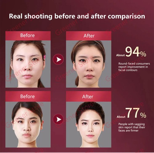 Facial Lifting Device LED Photon Therapy Face Slimming Massager V-Line Pro. - Picture 11 of 13