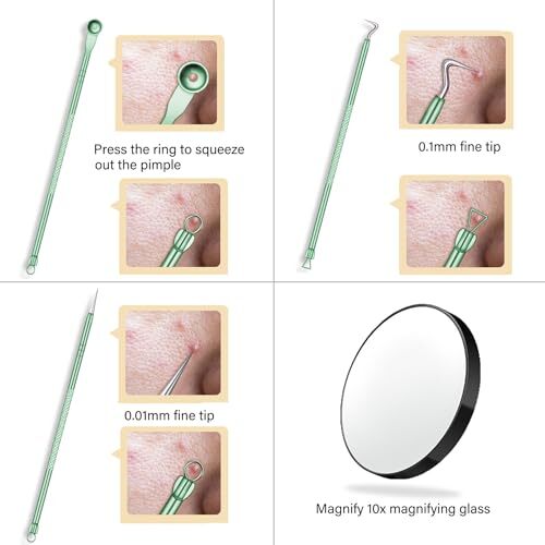 Professional Pimple Popper Tool Kit - 8 Pcs Blackhead Remover Comedone - Bild 6 von 7