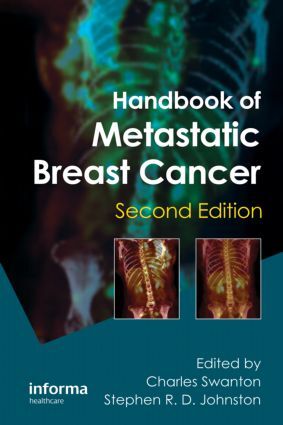 Handbook of Metastatic Breast Cancer - 2nd Edition
