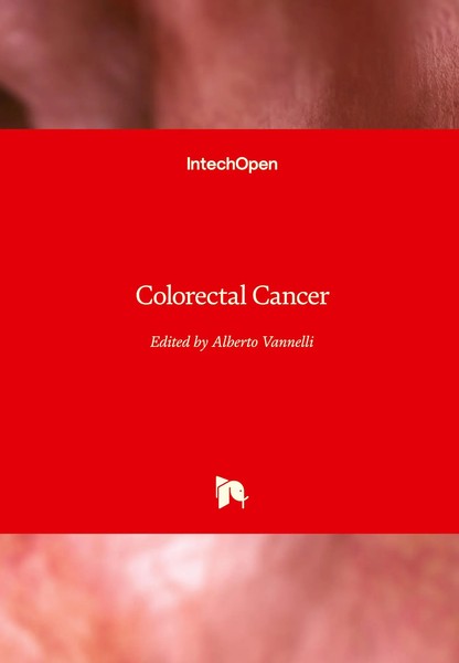 Alberto Vannelli | Colorectal Cancer | Buch | Englisch (2021) | Gebunden-image