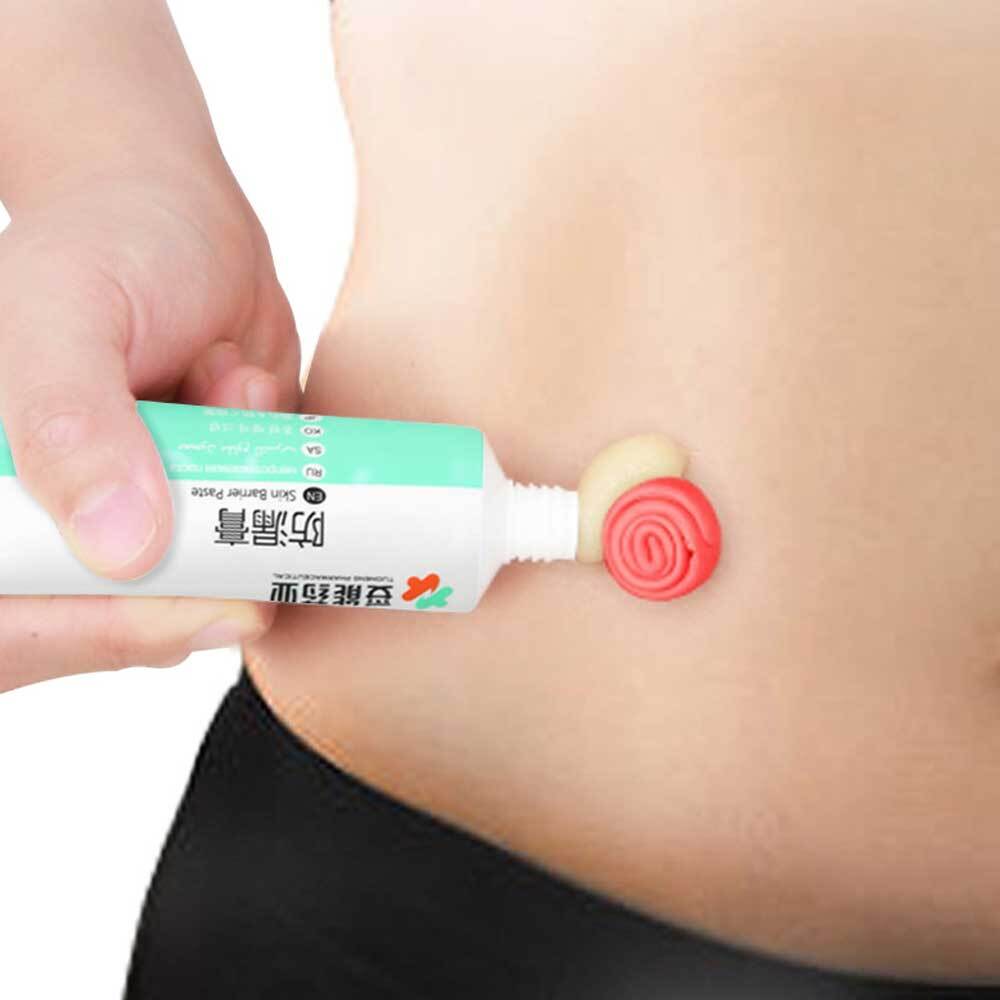 Skin Care Powder Stoma Accessories after Surgery Cream Barrier Paste Leak-proof