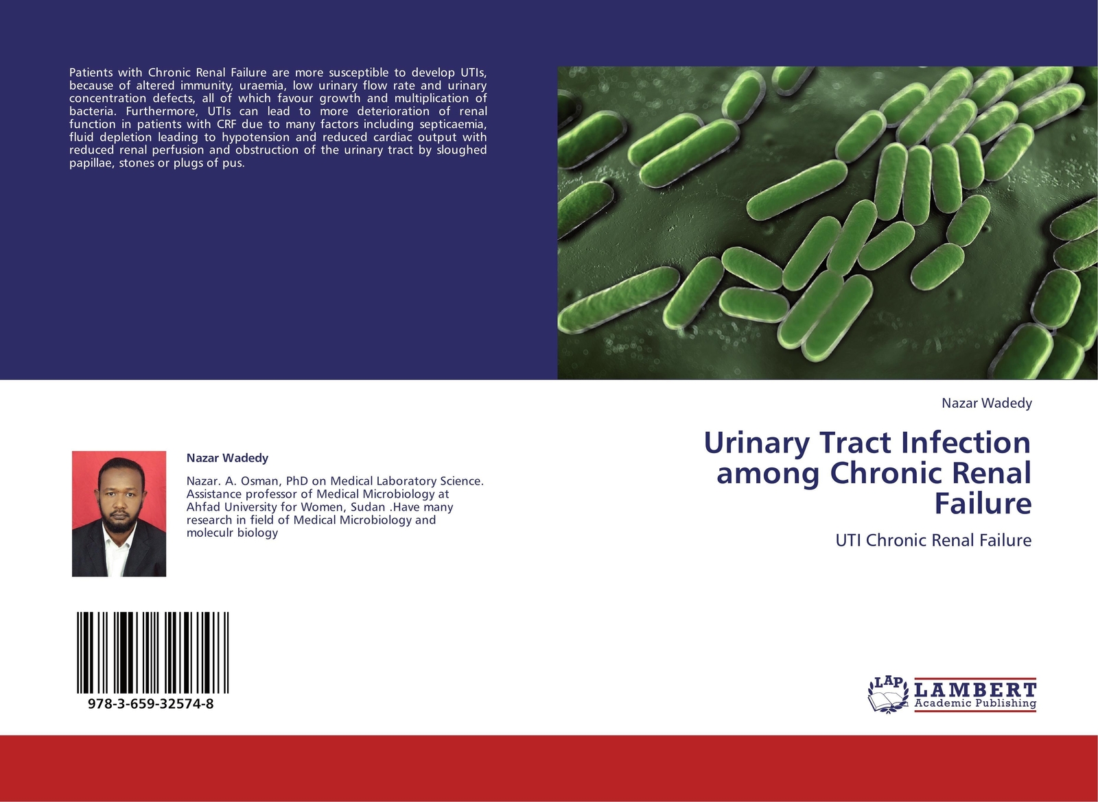 Thumbnail - Nazar Wadedy | Urinary Tract Infection Among Chronic Renal Failure |