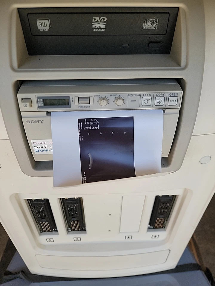 Máquina de ultrassom GE LOGIQ C3 Premium sem sonda FAÇA OFERTA PRECISA IR - Imagem 4 de 4