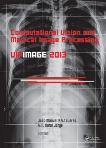 Computational Vision and Medical Image Processing IV by Joao ... - 9781138000810