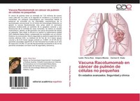 Vacuna Racotumomab En CáNcer De PulmóN De CéLulas No PequeñAs Leslie PéRez Ruiz