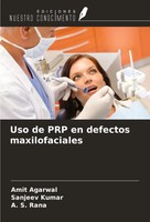 Uso De PRP En Defectos Maxilofaciales Amit Agarwal (U. A.) Taschenbuch Spanisch