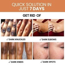 Skincare Knuckle Whitening Cream Dark Spots Dark Elbow Removal Moisturizing FS