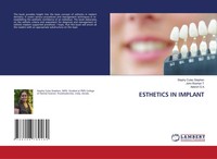 Esthetics IN Implant Stephy Culas Stephen (U. A.) Taschenbuch Englisch 2024