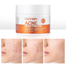 Acne Treatment for Face Hormonal Cystic Stubborn Acne Cream for Sensitive Skin