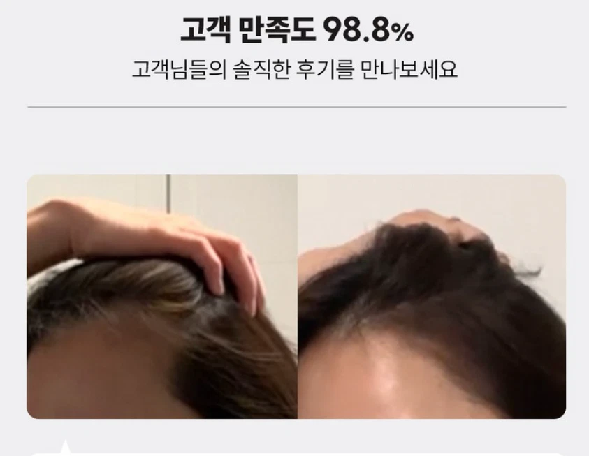 [LilyEve] Grow:Turn Exosome Ampoule 抗脱发头皮护理 100 毫升 K-Beauty — 第 3/4 张图片