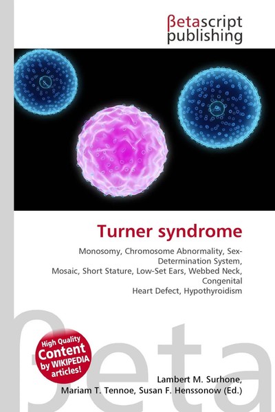 Lambert M. Surhone (U. A.) | Turner Syndrome | Taschenbuch | Englisch (2026)-image