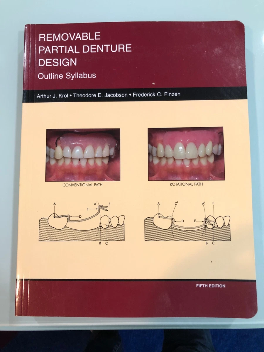 Removable Partial Denture Design