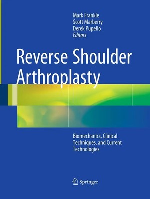 Mark Frankle (u. a.) | Reverse Shoulder Arthroplasty | Taschenbuch | Englisch