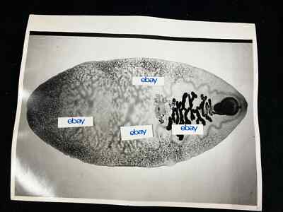 VINTAGE HUMAN PARASITOLOGY 11X14 ORIGINAL B&W PHOTO, FASCIOLOPSIS BUSKI