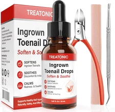 Treatonic Ingrown Toenail Treatment Kit Drops Stainless Steel Precision Clippers