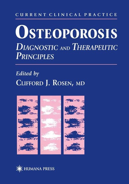 Clifford J. Rosen | Osteoporosis | Taschenbuch | Englisch (2012) | Xi | Humana-image