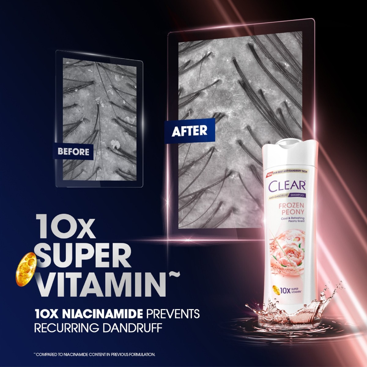 370ML/400ML Clear Shampoo Anti-Dandruff Ice Cool Menthol 370ML/400ML Clear Shampoo Anti-Dandruff Ice Cool Menthol