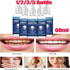 1/2/3/5Pack Dental Cavity Healing Tooth Armor Liquid - Helps Keep Gums Healthy