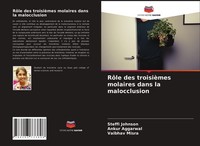 RôLe Des TroisièMes Molaires Dans La Malocclusion Steffi Johnson