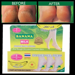 Cracked Heels Repair Treatment For Very Dry Feet Hard Skin Cream Very Effective Ebay
