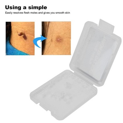 30Pcs Skin Tag Removal Rubber Bands Safe Micro Band Non Toxic Mole Wart Ski Cus-