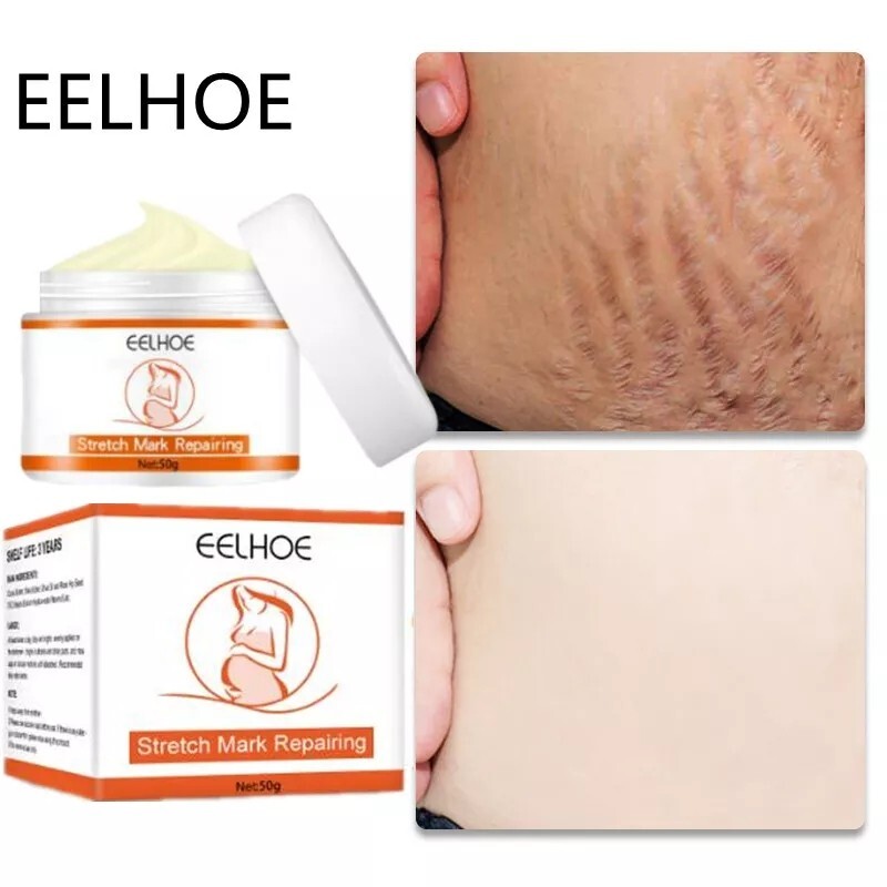 Crème vergeture et soin de la peau raffermissant pour votre routine bien-être post-grossesse