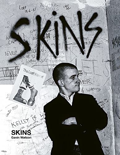 Skins Gavin Watson by Gavin Watson (Hardback Book) - Image 6