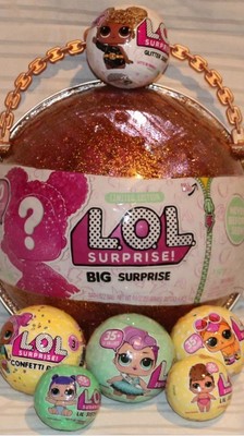 lol big surprise pearl edition