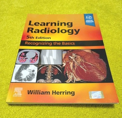 Learning Radiology : Recognizing the Basics, Paperback by Herring, William, L...