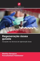 RegeneraçãO óSsea Guiada Mahika Borgave