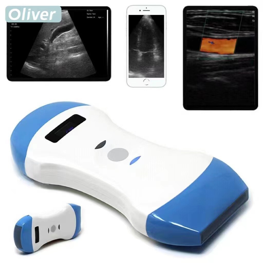 Wireless Ultrasound Probe 3 in 1 Scanner 128 element Portable Machine