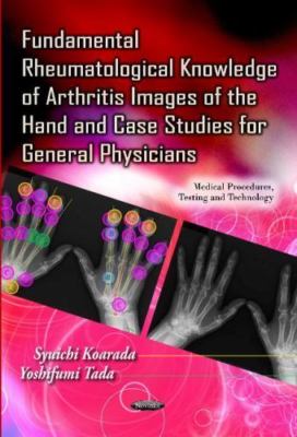 Fundamental Rheumatological Knowledge of Arthritis Images of the Hand and Cas...
