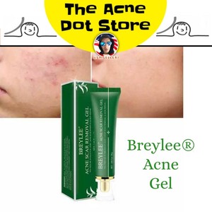 breylee acne treatment gel