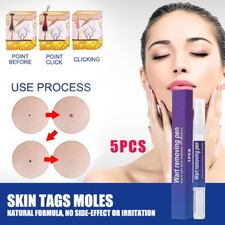 5pc 12 Hours Wart Remover Pen Skin Tag Mole Foot Corn Eliminate Warts Unisex 5ml