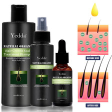 Yedda Hair Growth Spray Shampoo, and Anti Hair Lose Growth Essence,3 Bottles.