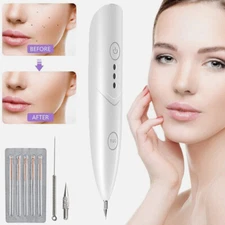 Laser Plasma Pen Face Freckle Remover Body Skin Mole Wart Dark Spot Removal