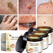 Bee Venom Skin Tag Removal Treatment Cream Body Care Mole Corn Wart Remover
