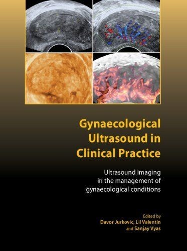 Gynaecological Ultrasound in Clinical Practice (Hardcover, 2009)