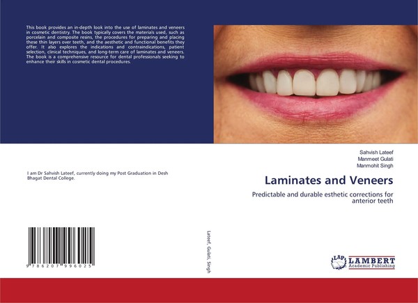 Sahvish Lateef (U. A.) | Laminates And Veneers | Taschenbuch | Englisch (2024)-image