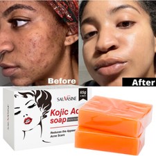 1-5X Kojic Acid Soap Dark Spot Whitening Turmeric Soap Skin Bleaching Lightening