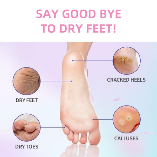 3 PCs Foot Moisturizer Cream for Dry Cracked Heels and Feet Hydrate Rough Skin - Picture 4 of 10