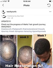 STIMULATE HAIR GROWTH- HAIR RESTORATION OIL"WACK-OIL" 100 ORGANIC ARGAN OIL 